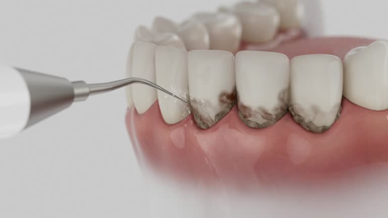 Trusted Invisalign Clear Aligners service in Winchester, TN - Dentist Open Now